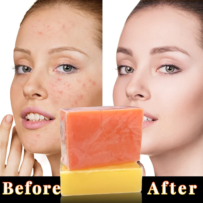 3PCS Kojic Acid Whitening Soap