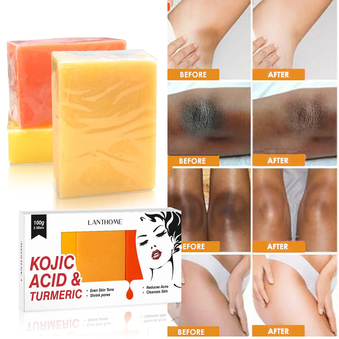 3PCS Kojic Acid Whitening Soap